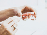 Dental Sealants (11375)