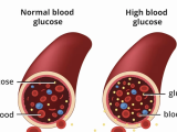 Understanding Diabetes: A Comprehensive Course