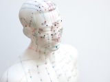 The Role of Acupuncture in Everyday Health