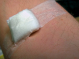 Original source: https://live.staticflickr.com/8408/28670738991_0ae8541d04_h.jpg Phlebotomy