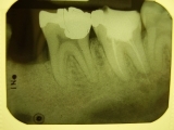 Techniques in Dental Radiology for Dental Assistants (Hybrid) (12857)