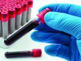 Original source: https://s3.amazonaws.com/coursestorm/live/media/24d0f41c29bc11efaf130affdf56ea21 Phlebotomy